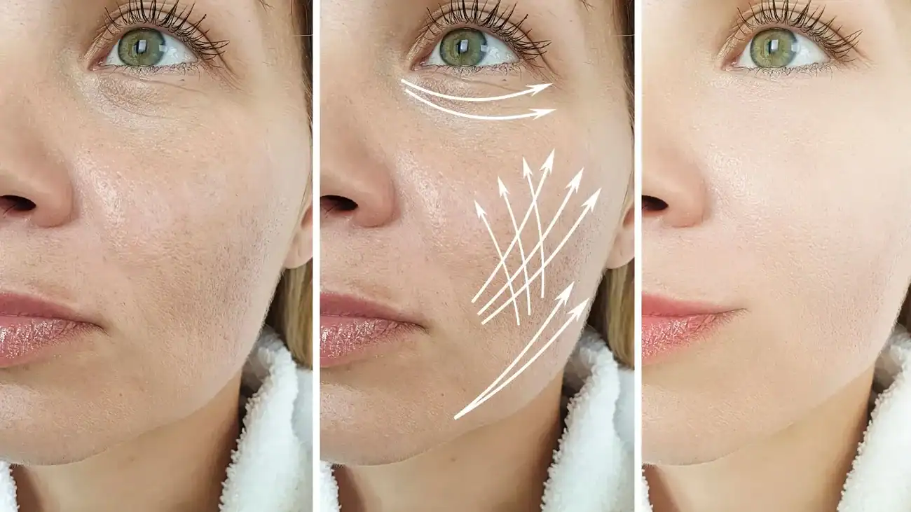 Can One Treatment Really Tackle More Than One Skin Concern Cranleigh?