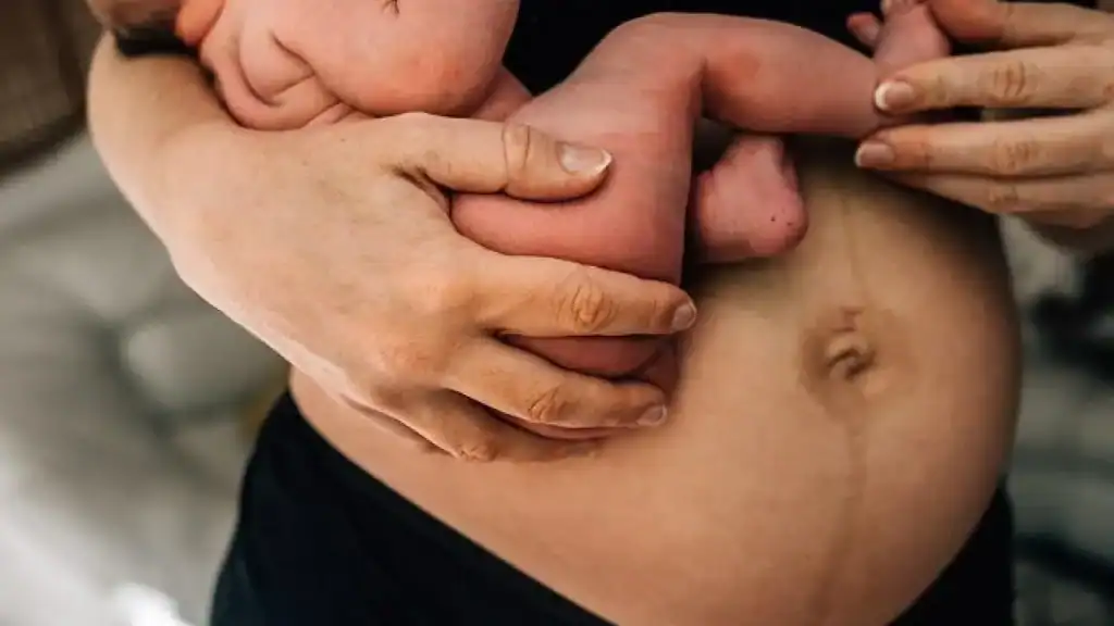 Why Is My Stomach Still Big After Pregnancy Cranleigh?